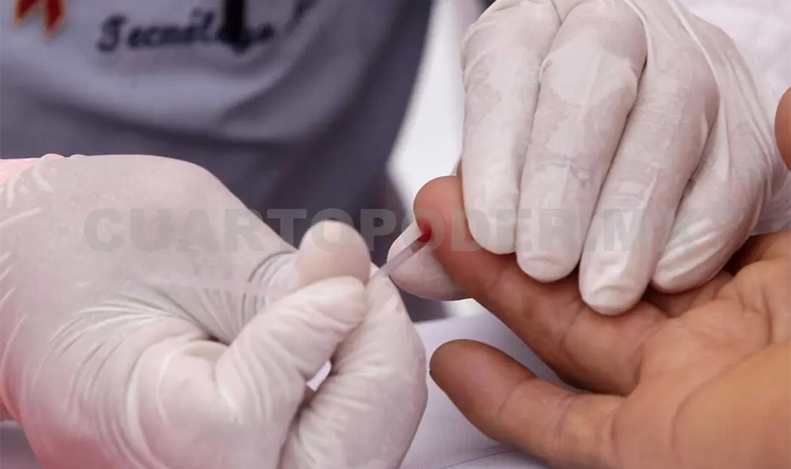 Chavero dijo que debe haber más acceso a las pruebas, tratamiento y combatir la discriminación. Diego Pérez / CP