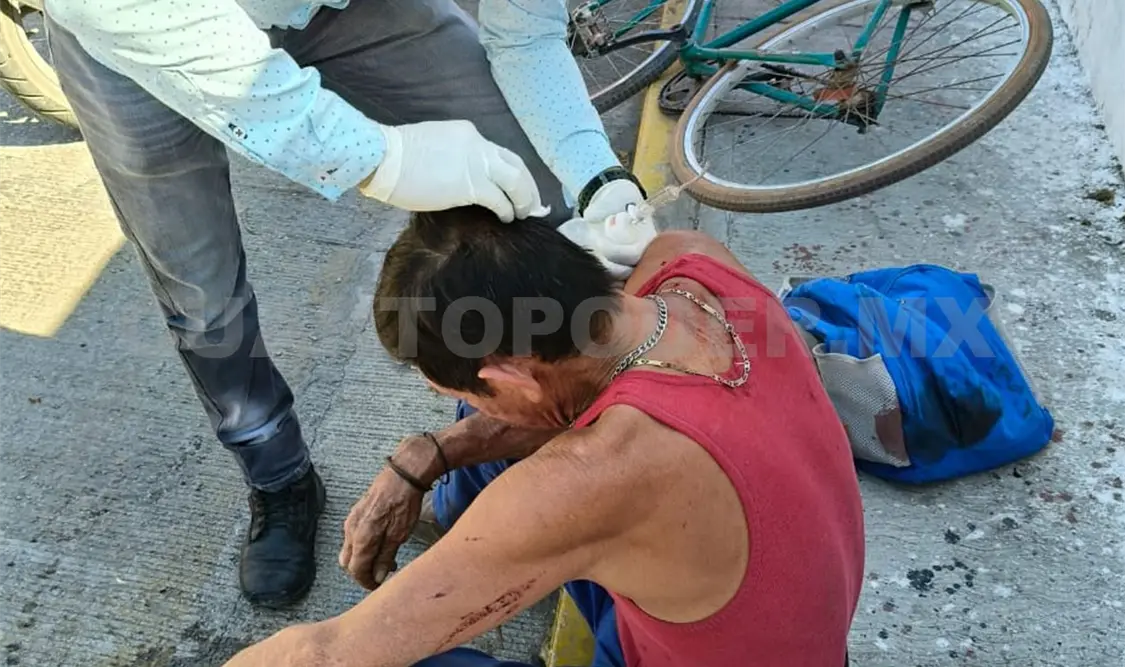 Atropellan a ciclista y resulta malherido