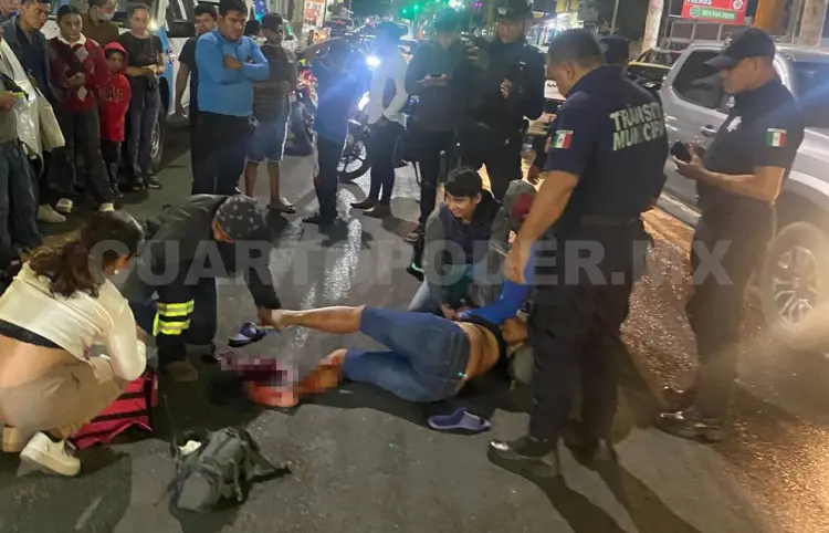 Atropellan a mujer y le fracturan los pies