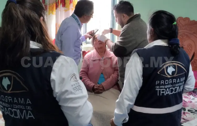 Tracoma: enfermedad de la pobreza