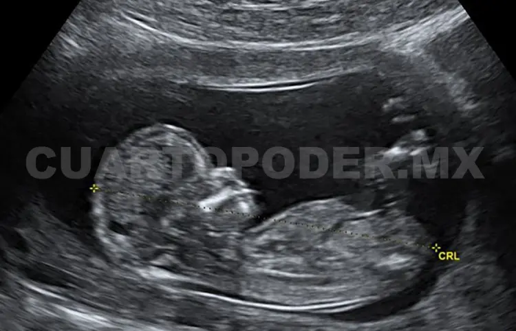 Falta sinergia para acceso a abortos seguros