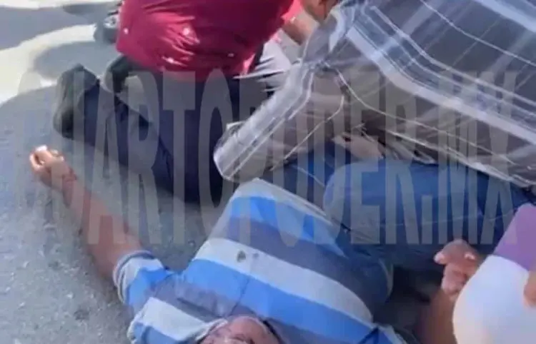 Pierde el equilibrio y cae por culpa de un perro