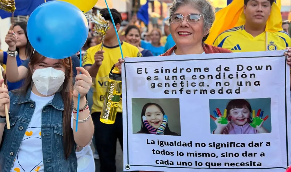 El 21 de marzo de cada año se conmemora el Día Mundial del Síndrome de Down. Cortesía