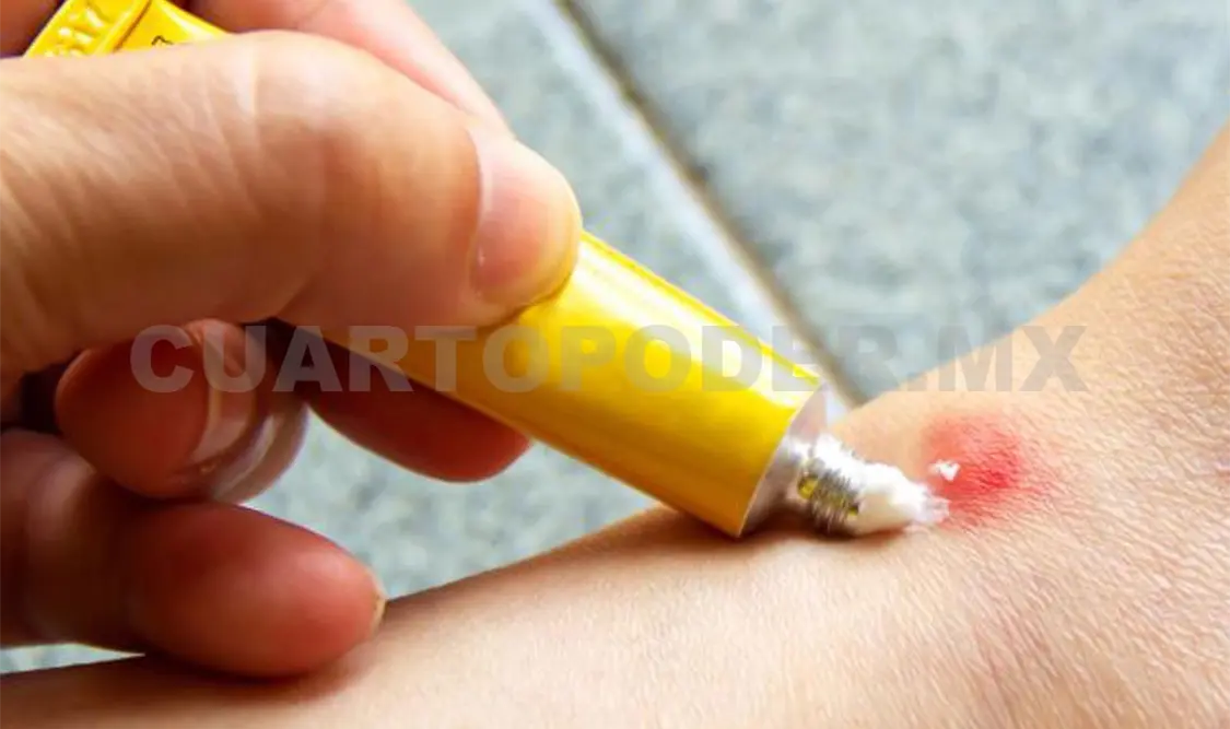 Este mosquito es uno de los vectores que causa una picadura dolorosa. Manuel Martínez / CP