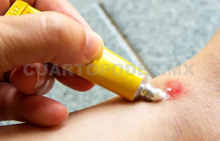 Molestia ante presencia de chaquiste en San Cristóbal