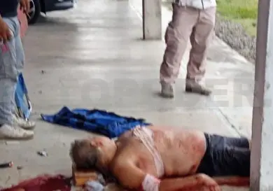Le dieron seis balazos; está grave de salud