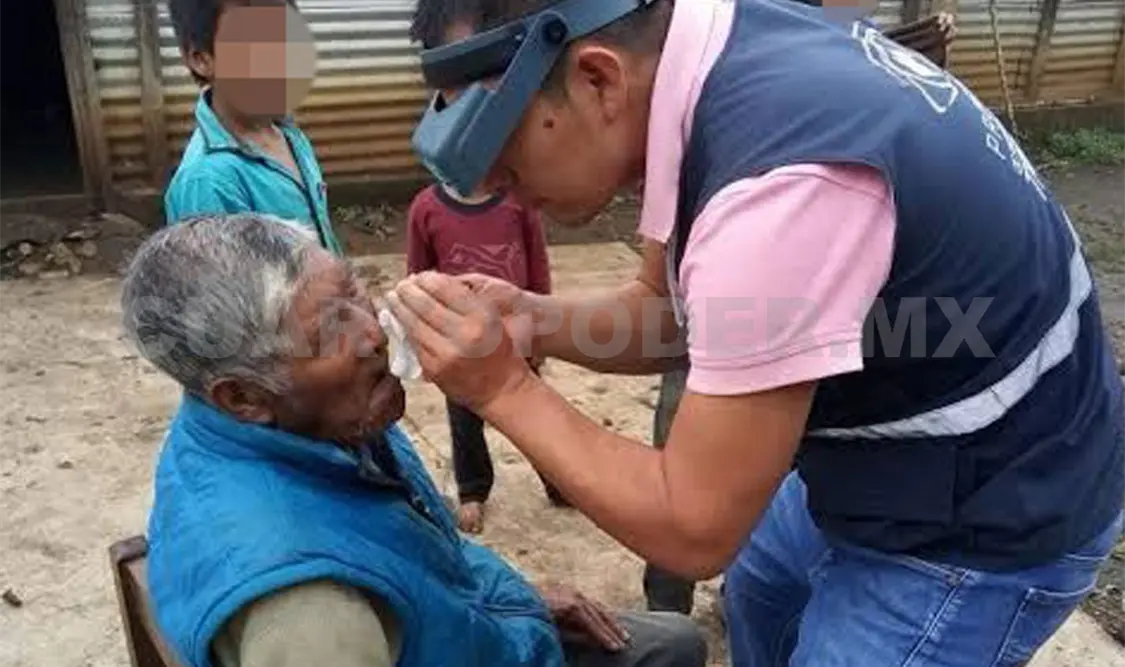 Chiapas, libre de tracoma; aunque sigue en riesgo