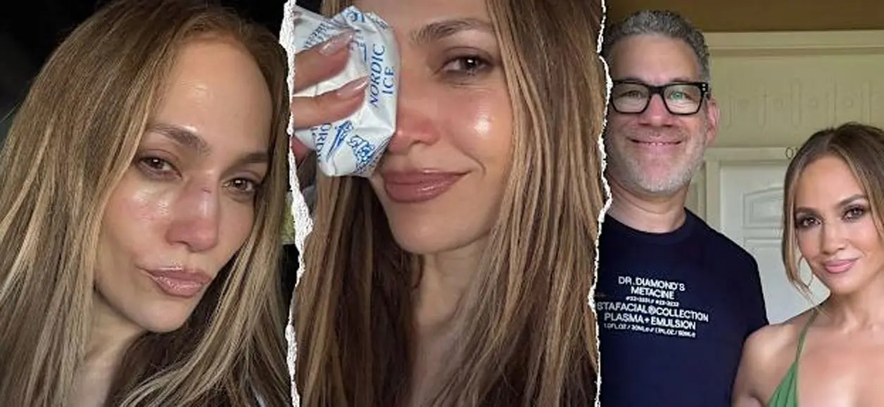 JLo muestra lesiones en su rostro