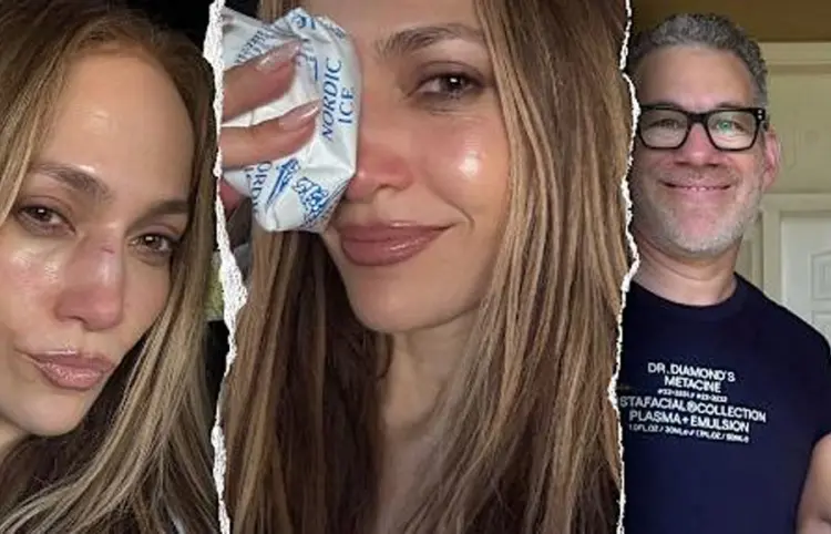 JLo muestra lesiones en su rostro