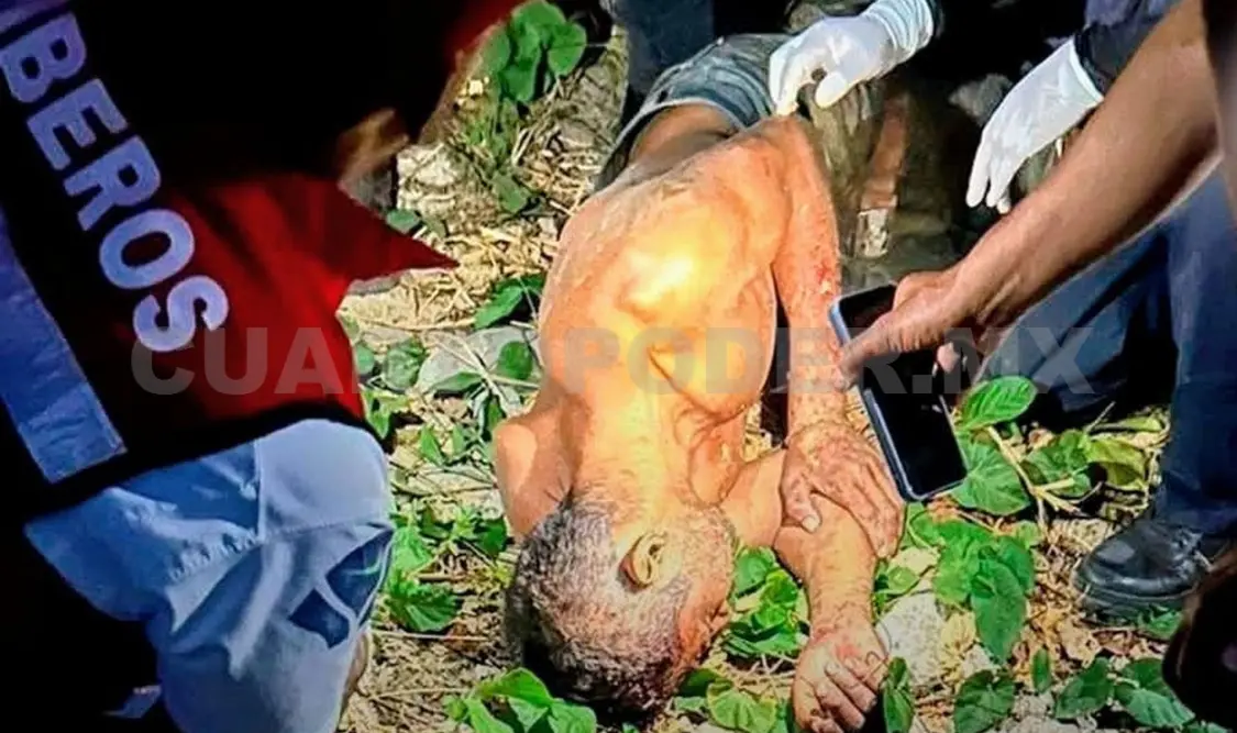 El hombre acabó herido de la frente con un machete. Cortesía