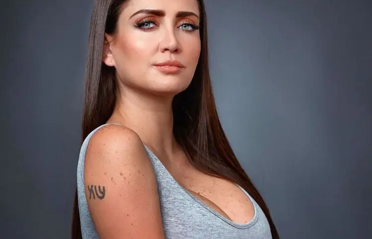 Celia hablará de cirugías fallidas