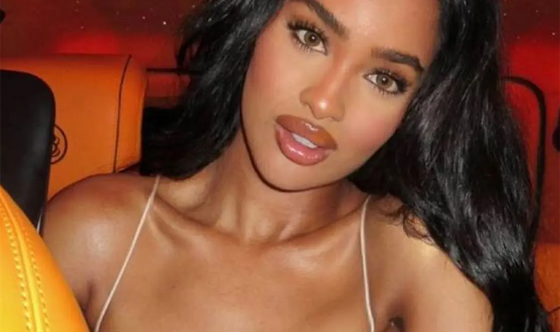 Miss Somalia, víctima de mutilación
