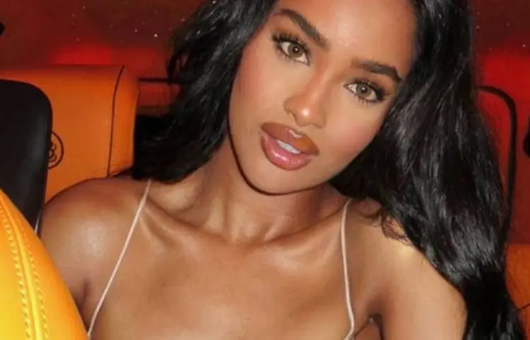 Miss Somalia, víctima de mutilación