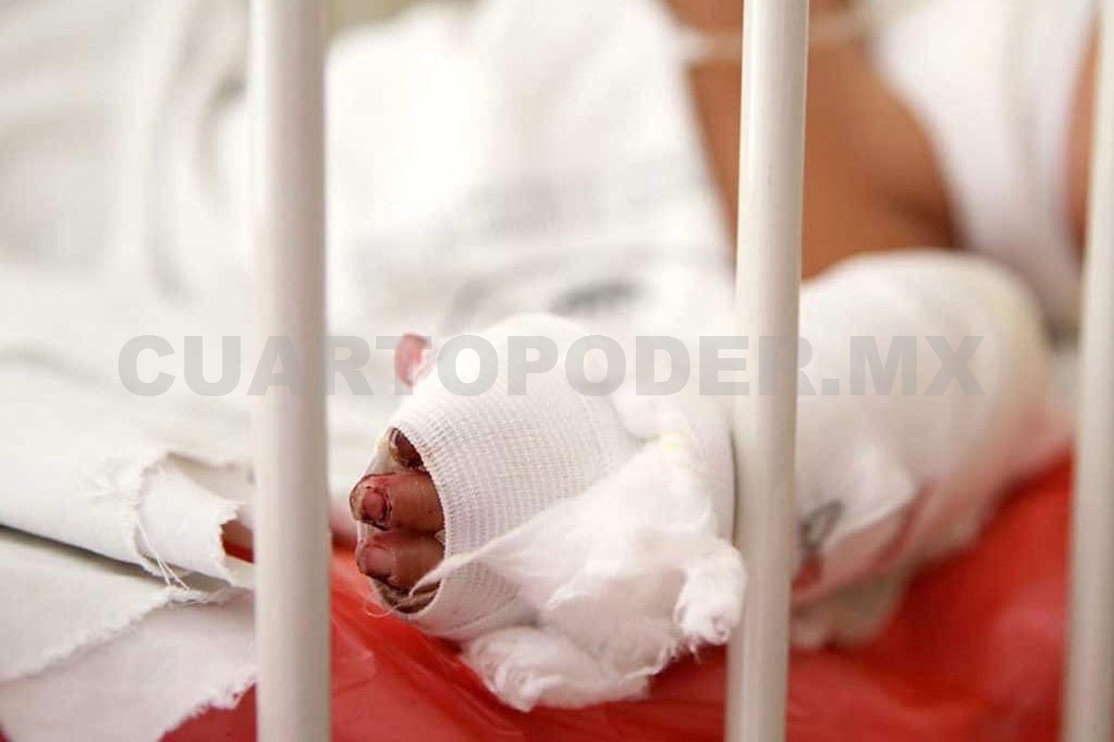 Sigue alta la incidencia de menores quemados