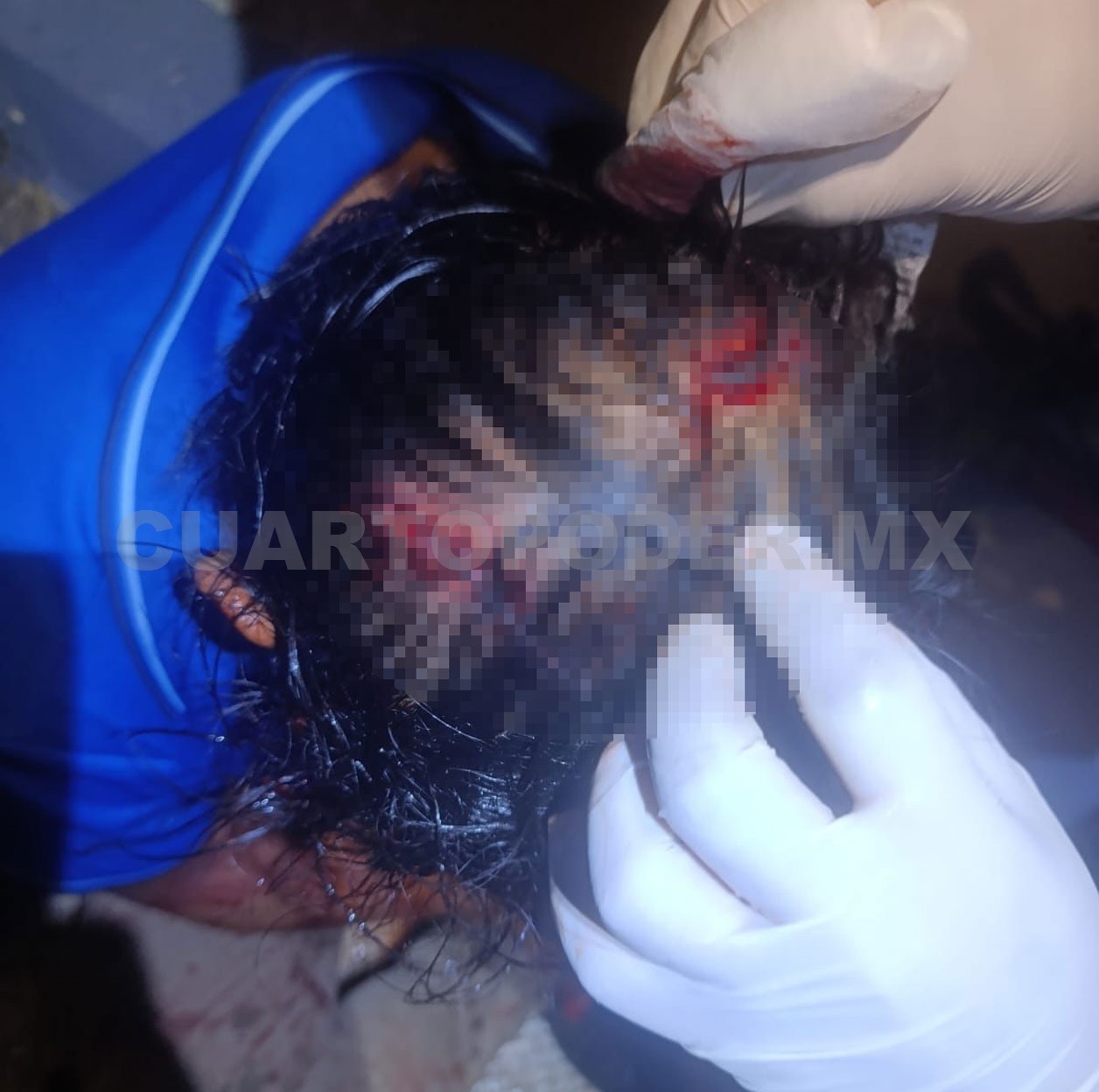 Apedrean a hombre en Jardines del Norte