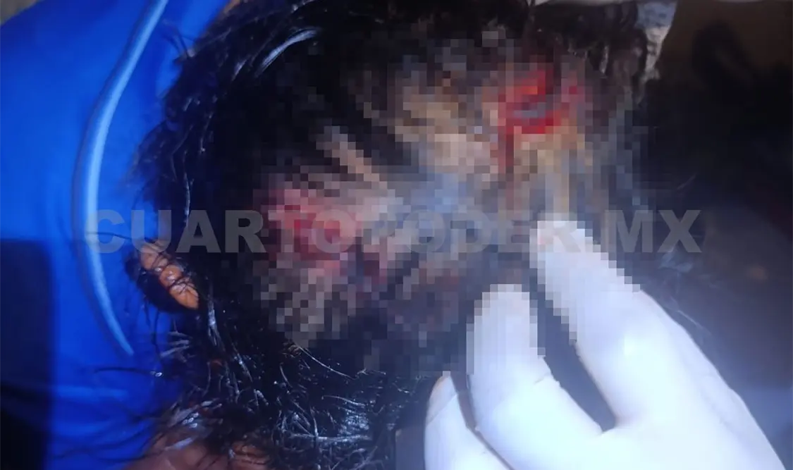 El individuo acabó con múltiples heridas en la cabeza y en las extremidades. Ulises Villalobos / CP