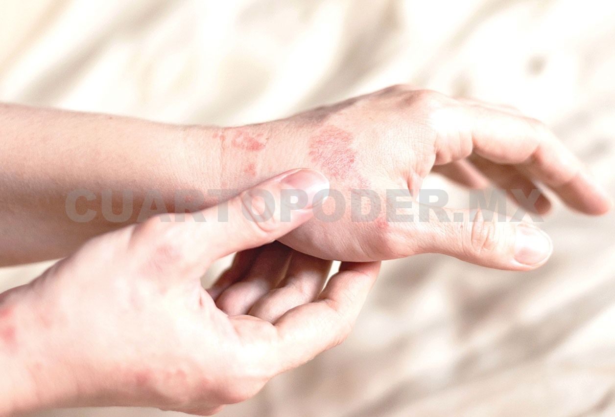 Radiación de pantallas también afecta la piel