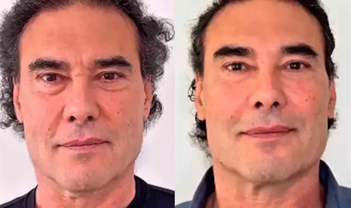 Yáñez se da una “manita de gato”