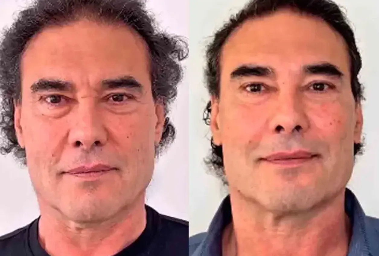 Yáñez se da una “manita de gato”