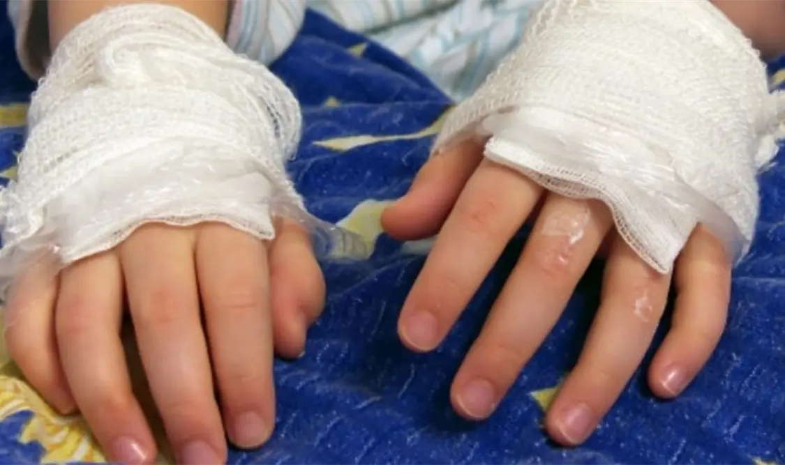 La joven es reportada como grave. Cortesía