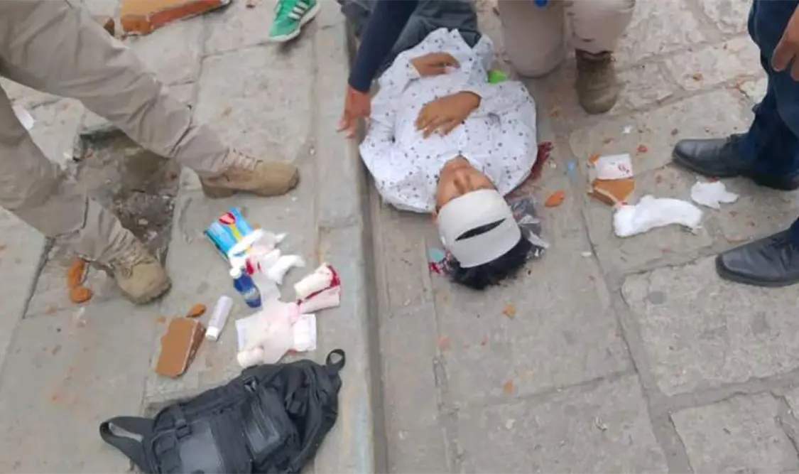 Un menor de 16 años, recibió un golpe en la cabeza tras la caída de un pedazo de cantera. Cortesía