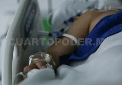 Detectan a persona con viruela símica