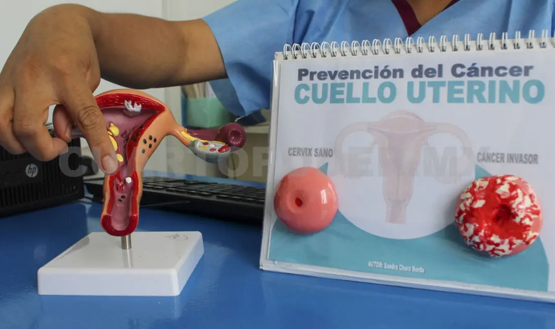 El especialista dijo que la meta que debe fijarse en México es la detección temprana. Diego Pérez / CP