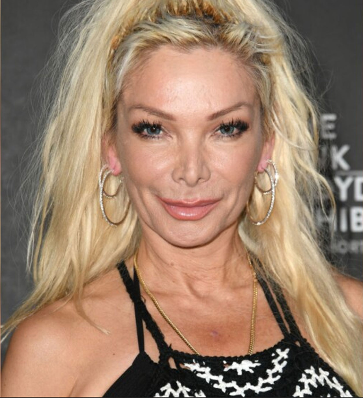 Marisela enfrenta una recaída