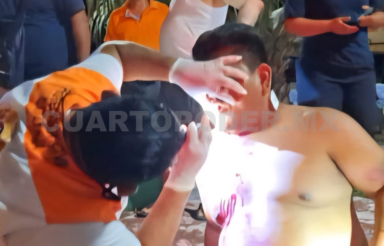 En la medianoche atacan a balazos al “Mojino”