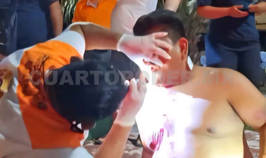 Los agresores hirieron al sujeto en el rostro y en la espalda baja. Genaro Sánchez / CP