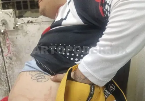 Lo acuchillan al tratar de robarle su motocicleta