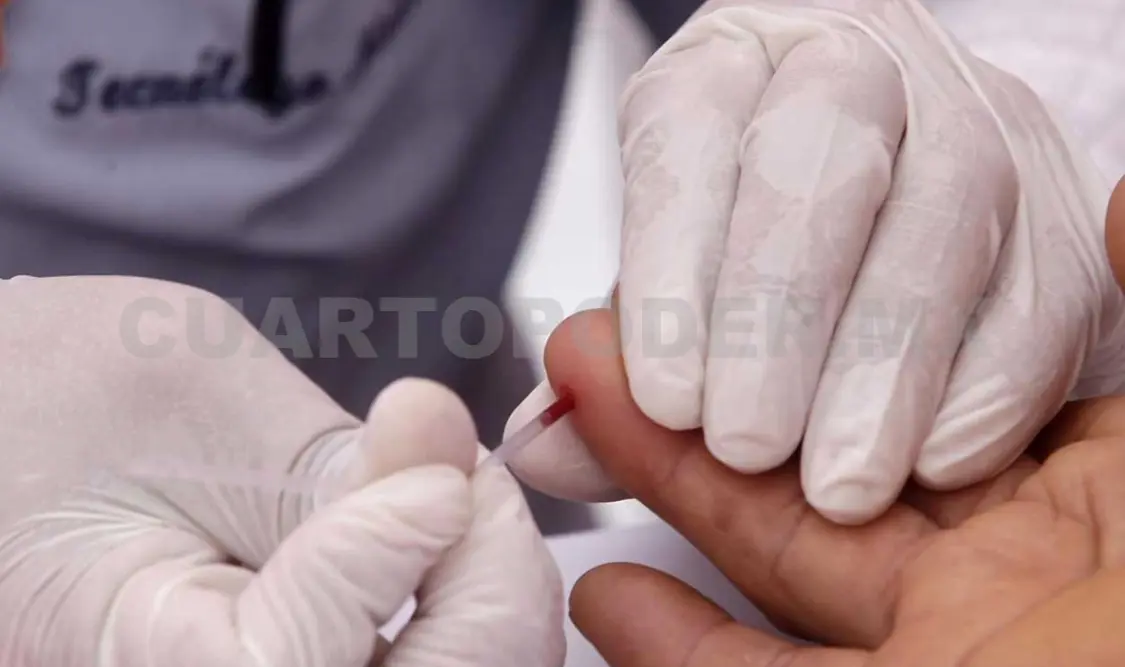 El especialista dijo que las instituciones y organizaciones trabajan en vinculación contra el VIH/Sida. Diego Pérez / CP