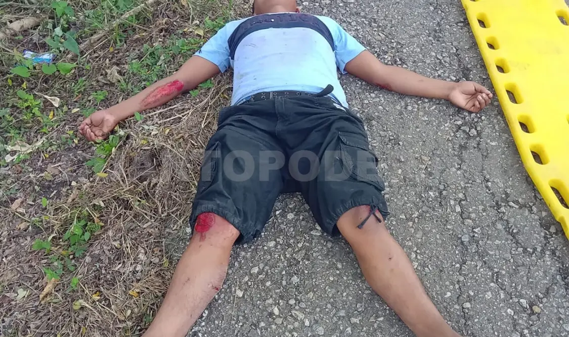 Ambos fueron hospitalizados con múltiples lesiones tras festejar con alcohol en Tila. Genaro Sánchez / CP