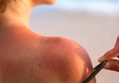 Errores al usar autobronceadores en casa Errores al usar autobronceadores en casa