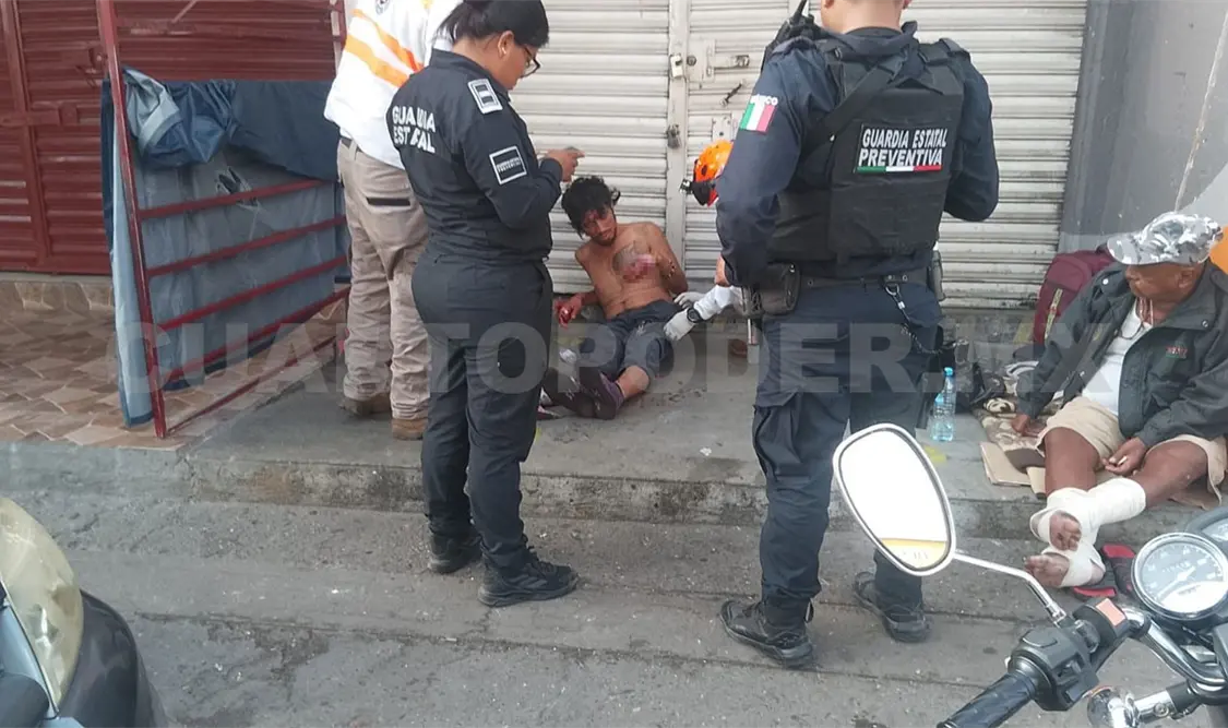 El individuo fue encontrado con dos dedos amputados, en el barrio El Calvario. Ulises Villalobos / CP