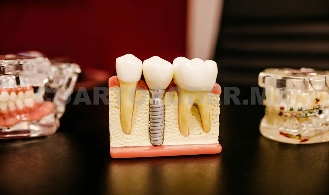 El odontólogo dijo que la limpieza dental en casa y semestral en el odontólogo es clave. Guillermo Ramos / CP