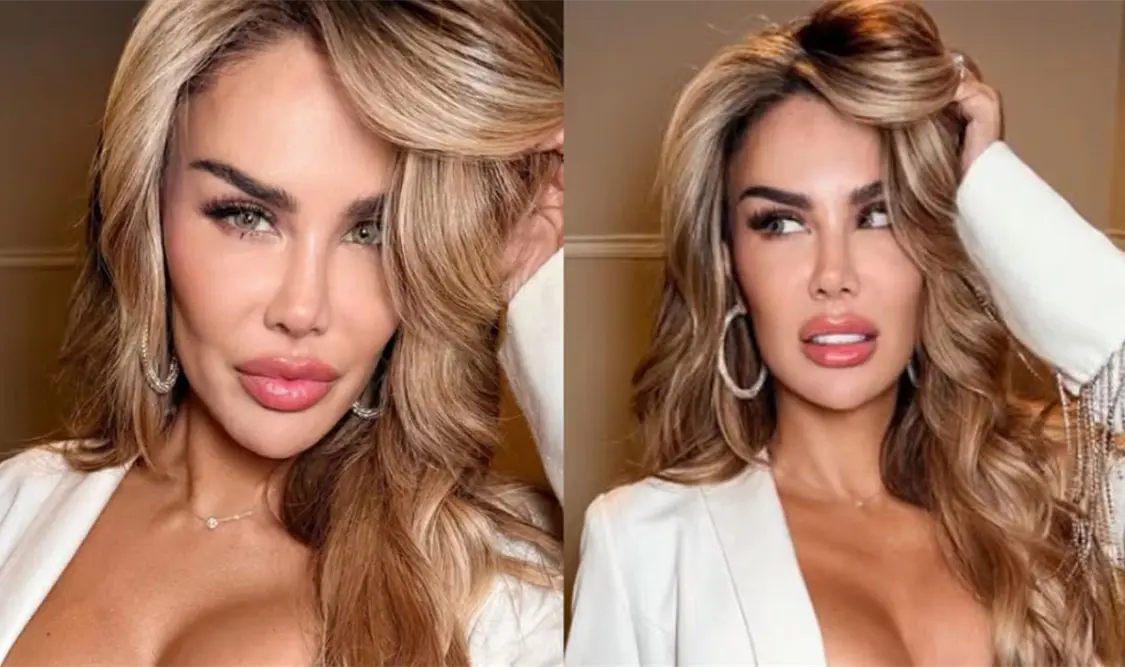 Ninel cambia el color de sus ojos