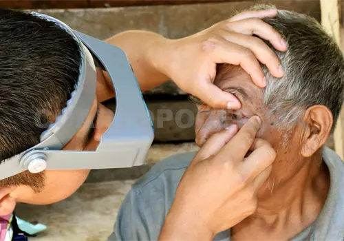 Redoblan esfuerzos para combatir el tracoma