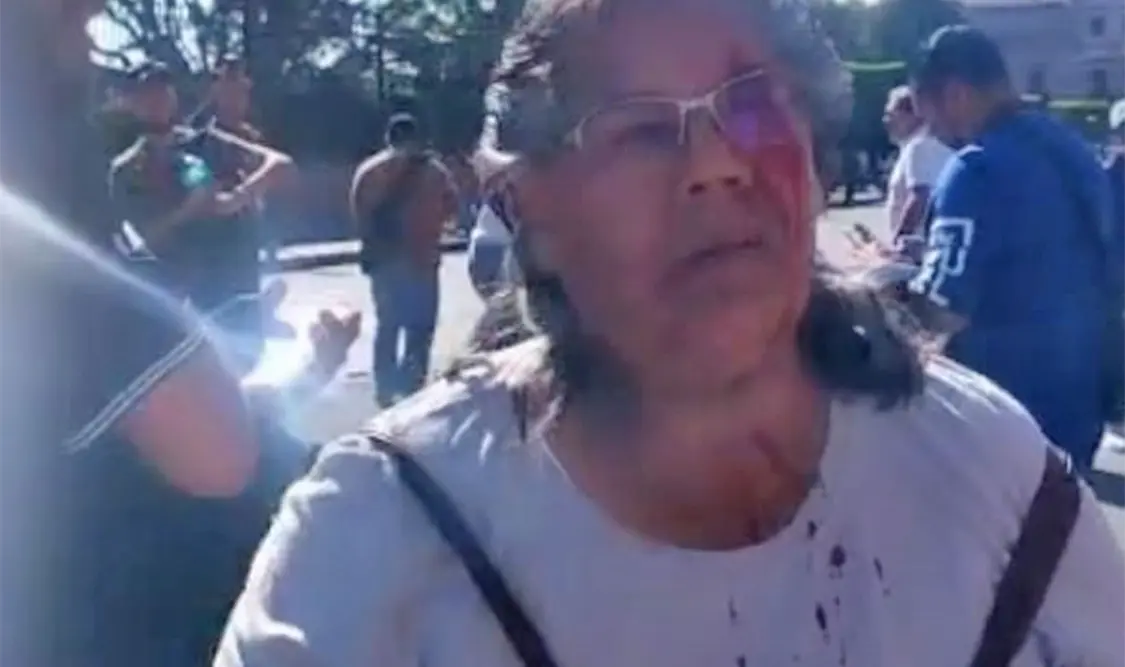 Las agresiones que sufrió la periodista Liliana Jiménez Nieto. Cortesía