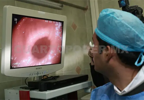 Cáncer de estómago, de los más frecuentes y letales en México Cáncer de estómago, de los más frecuentes y letales en México