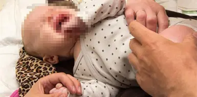 Panel recomienda no vacunar contra la hepatitis B en EUA