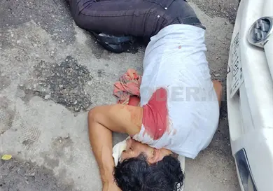 Casi se desangra al ser herido con un cuchillo en atraco