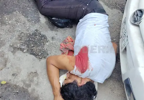 Casi se desangra al ser herido con un cuchillo en atraco Casi se desangra al ser herido con un cuchillo en atraco