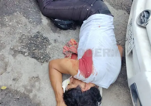 Casi se desangra al ser herido con un cuchillo en atraco Casi se desangra al ser herido con un cuchillo en atraco