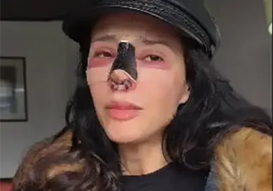 Cirugía estética de Dorismar sale mal Cirugía estética de Dorismar sale mal