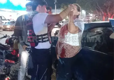 Acaba con el rostro herido Acaba con el rostro herido