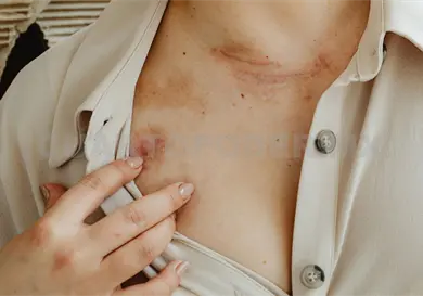 Afecta todo el a&ntilde;o radiaci&oacute;n UV