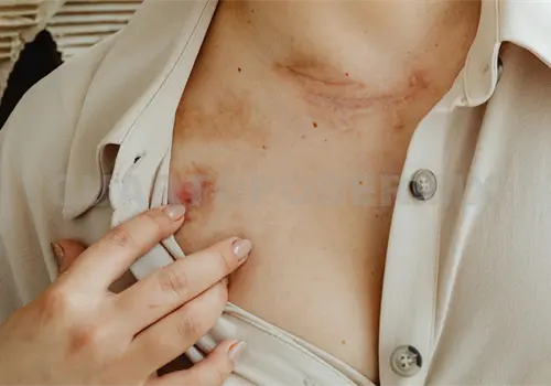 Afecta todo el a&ntilde;o radiaci&oacute;n UV