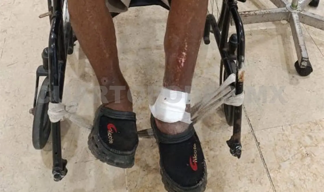 La dependencia indicó que se mantiene la vigilancia epidemiológica y búsqueda intencionada de casos. Víctor Sánchez / CP