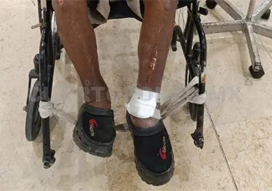 Registran cuatro nuevos casos de miasis en Chiapas